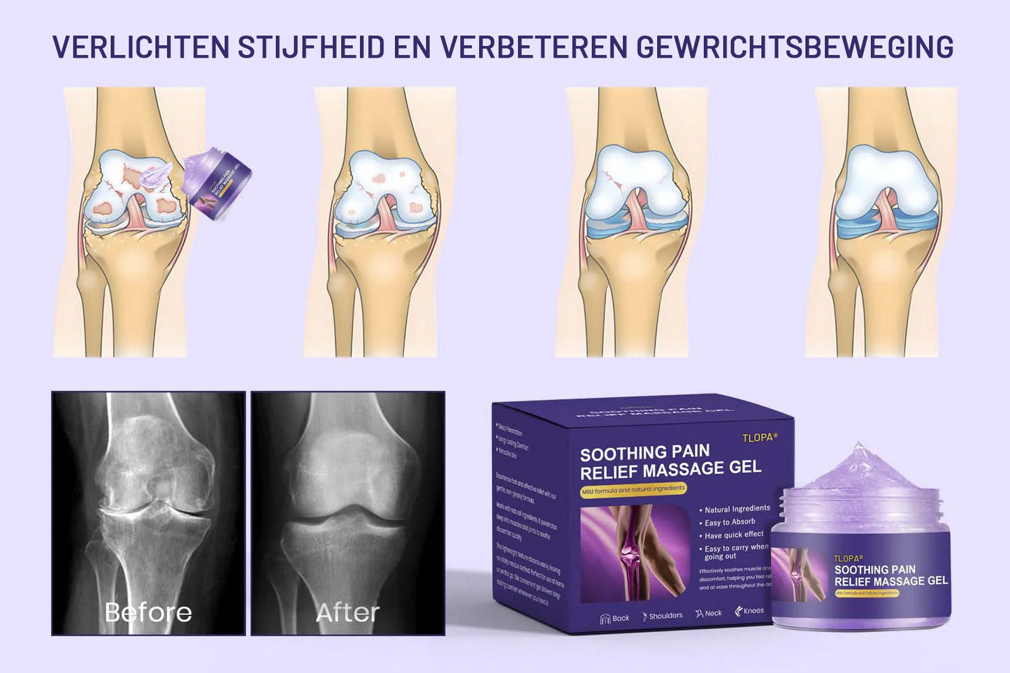 [Officiële winkel]🌟 TLOPA® Natuurlijke pijnstillende gel – 💪Snel absorberend en langdurig comfort voor pijnlijke spieren en gewrichten🌱