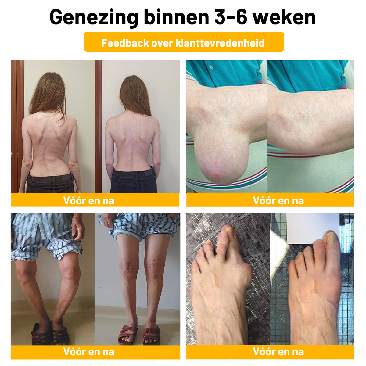 ⚡ Flash Sale: 𝗧𝗟𝗢𝗣𝗔® Upgrade nu naar het VIP-kortingsplan voor gewrichtspijnverlichting - 50% korting ⏳ (slechts 72 uur!) ✨