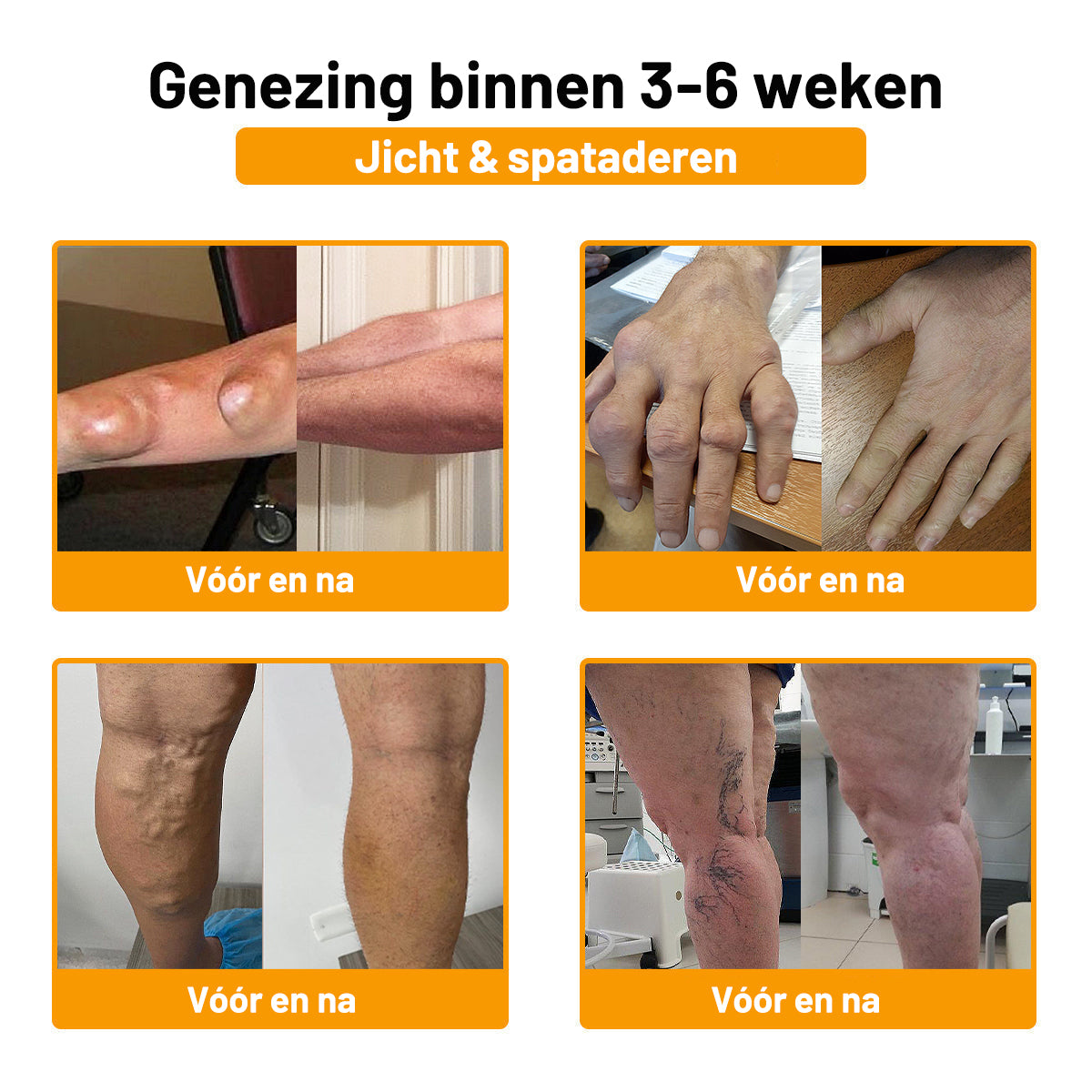 ⚡ Flash Sale: 𝗧𝗟𝗢𝗣𝗔® Upgrade nu naar het VIP-kortingsplan voor gewrichtspijnverlichting - 50% korting ⏳ (slechts 72 uur!) ✨