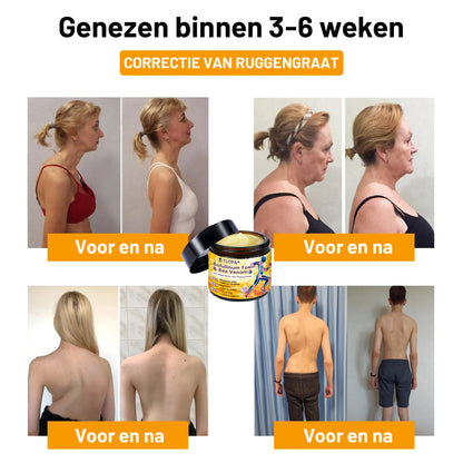 𝗧𝗟𝗢𝗣𝗔® Botox en Bijengif Pijnstillende Botherstellende Crème 丨💎 Nederlandse Orthopaedische Vereniging (NOV)💎(👨‍⚕️Aanbevolen door artsen: Geschikt voor mensen met gewrichtspijn, Puur natuurlijk extract, Gemakkelijk opneembaar, Pijnverlichtend)🌱