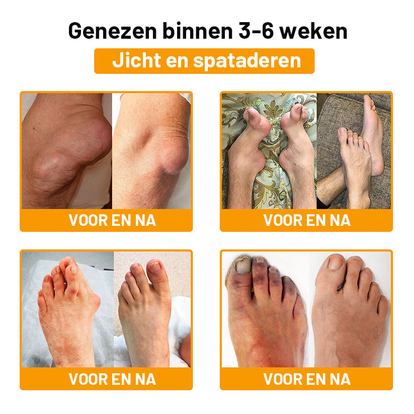 ⚡ Flash Sale: 𝗧𝗟𝗢𝗣𝗔® Upgrade nu naar het VIP-kortingsplan voor gewrichtspijnverlichting - 50% korting ⏳ (slechts 72 uur!) ✨