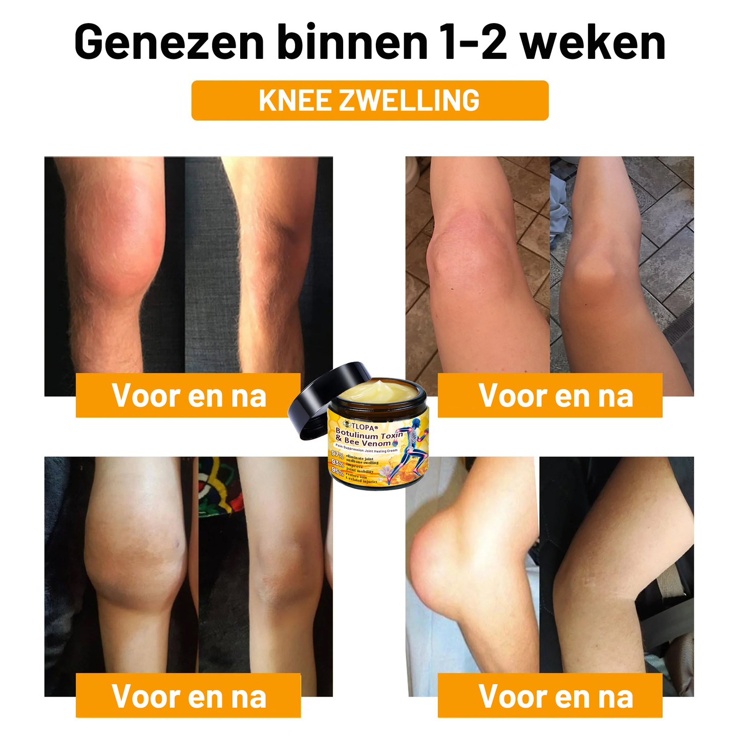 𝗧𝗟𝗢𝗣𝗔® Botox en Bijengif Pijnstillende Botherstellende Crème 丨💎 Nederlandse Orthopaedische Vereniging (NOV)💎(👨‍⚕️Aanbevolen door artsen: Geschikt voor mensen met gewrichtspijn, Puur natuurlijk extract, Gemakkelijk opneembaar, Pijnverlichtend)🌱
